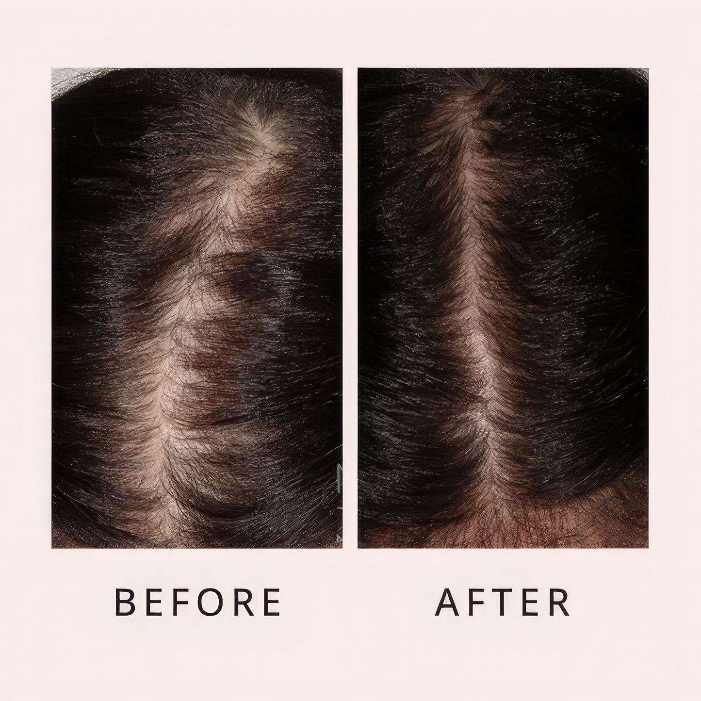 Luxo Hair Growth Serum