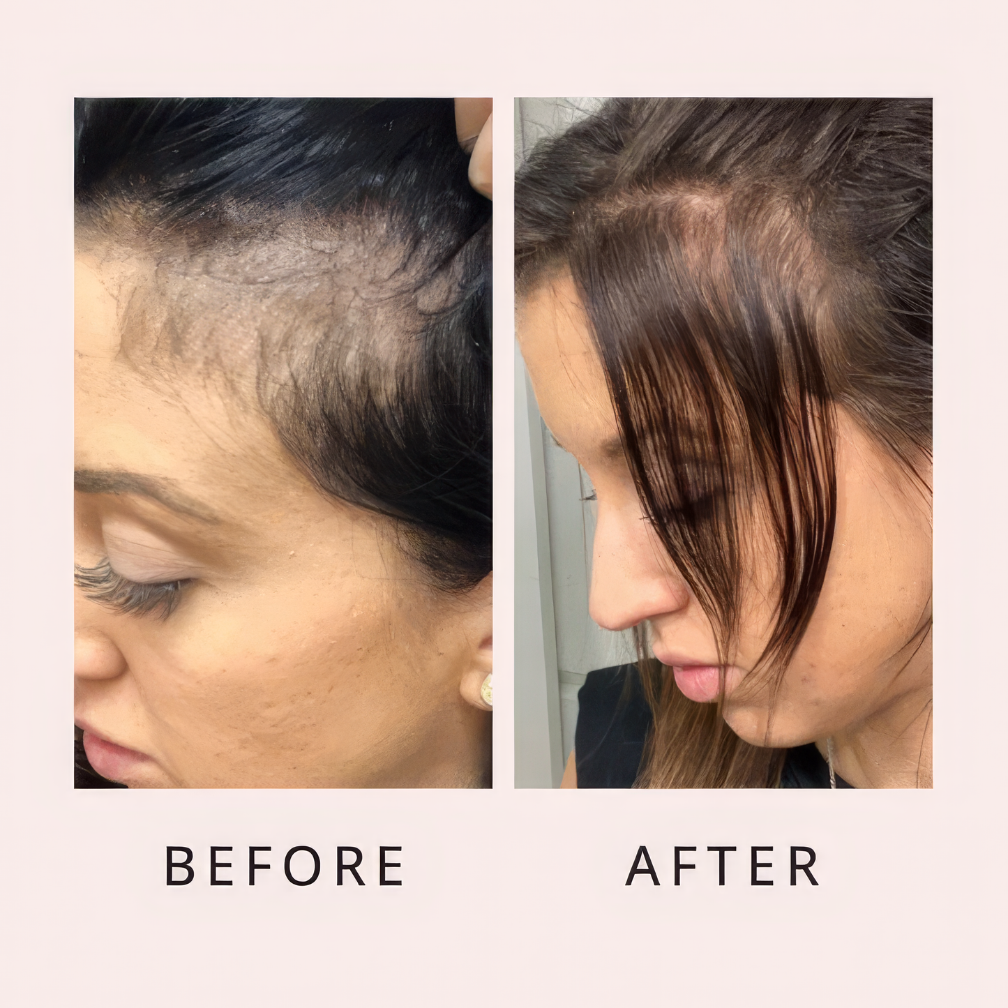 Luxo Hair Growth Serum