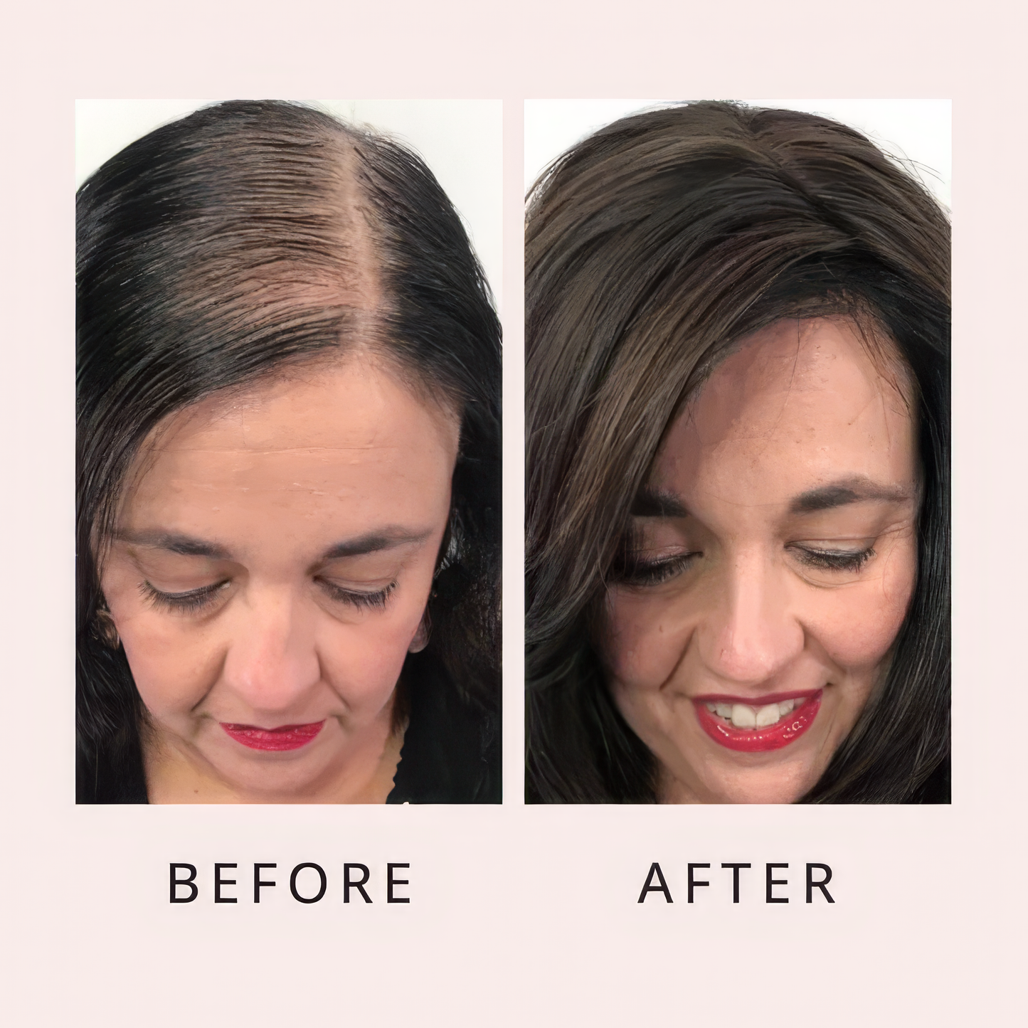 Luxo Hair Growth Serum